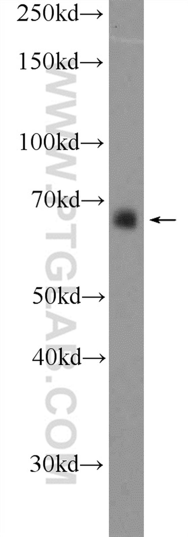 RBM39 Antibody in Western Blot (WB)