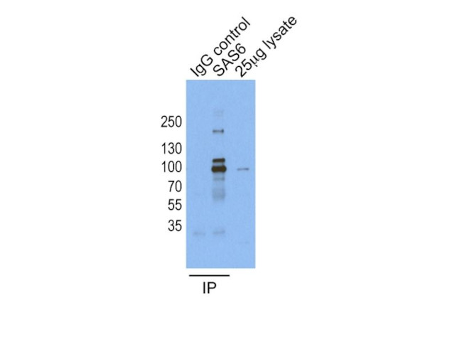 SASS6 Antibody in Immunoprecipitation (IP)