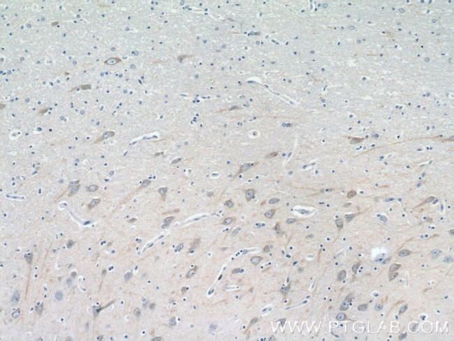 CHRNA7 Antibody in Immunohistochemistry (Paraffin) (IHC (P))