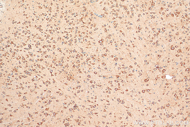 CHRNA7 Antibody in Immunohistochemistry (Paraffin) (IHC (P))