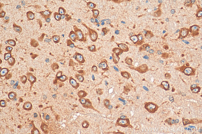 CHRNA7 Antibody in Immunohistochemistry (Paraffin) (IHC (P))