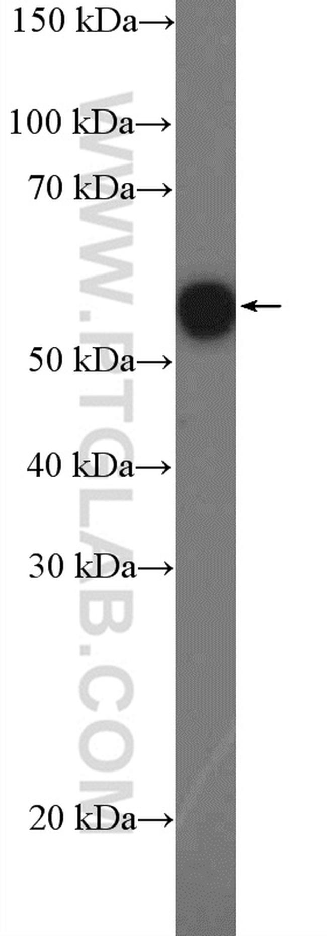 CHRNA7 Antibody in Western Blot (WB)