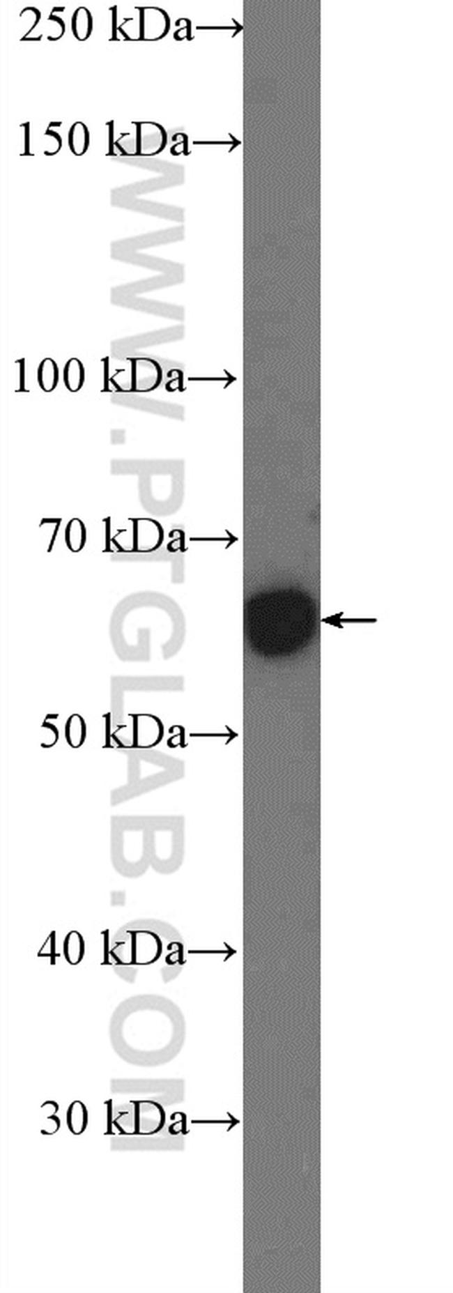 CHRNA7 Antibody in Western Blot (WB)