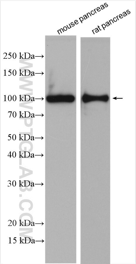 ALDH1L2 Antibody in Western Blot (WB)