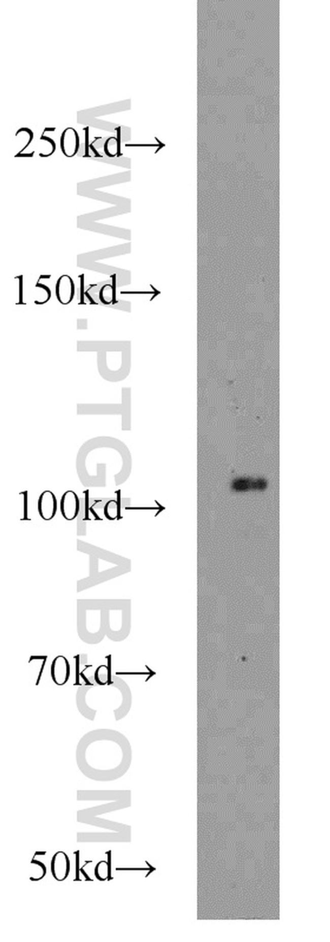 ALDH1L2 Antibody in Western Blot (WB)