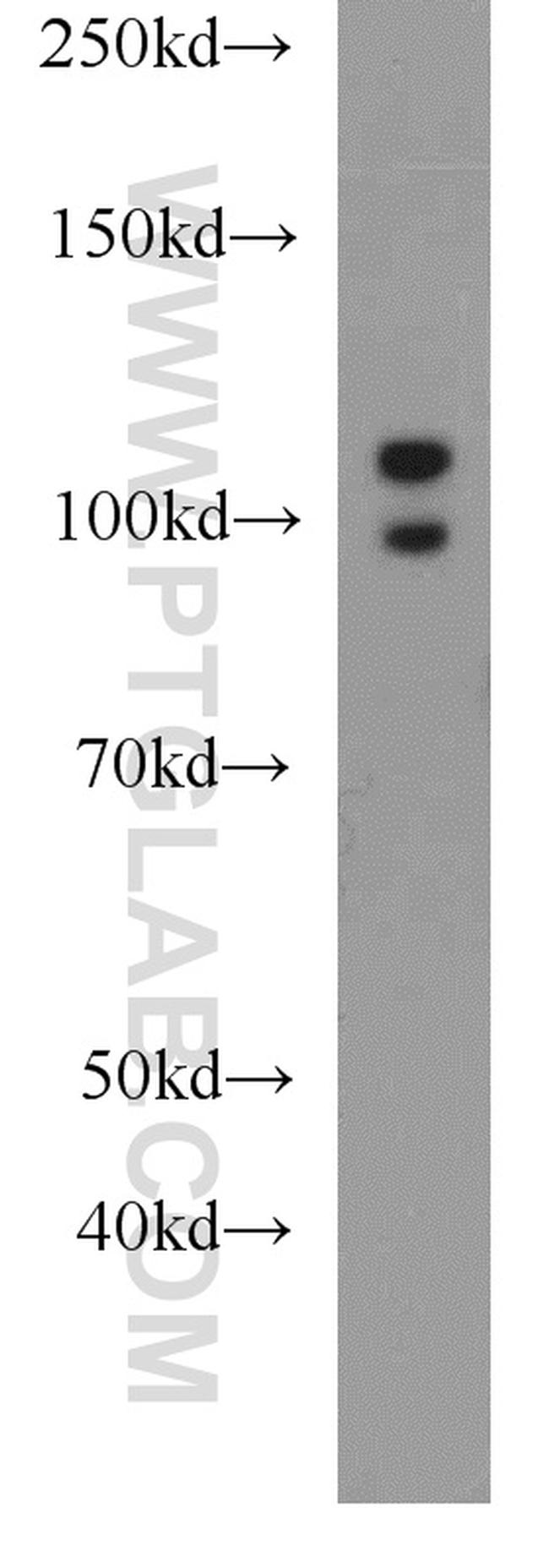 ALDH1L2 Antibody in Western Blot (WB)