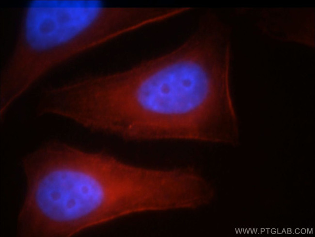 MYH10 Antibody in Immunocytochemistry (ICC/IF)