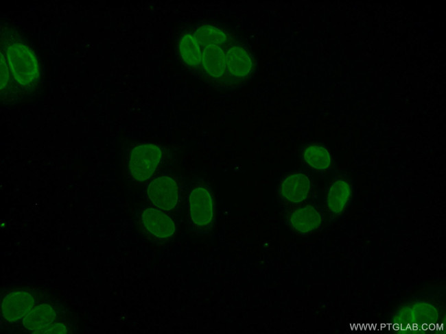 TOR1AIP1 Antibody in Immunocytochemistry (ICC/IF)