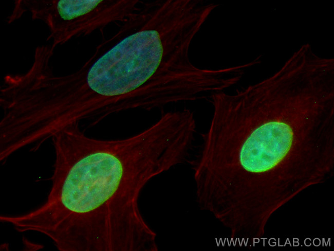 TOR1AIP1 Antibody in Immunocytochemistry (ICC/IF)