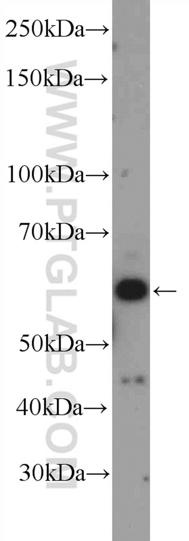 LHX6 Antibody in Western Blot (WB)