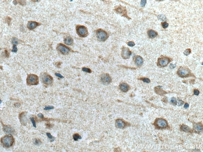 FAM134B Antibody in Immunohistochemistry (Paraffin) (IHC (P))