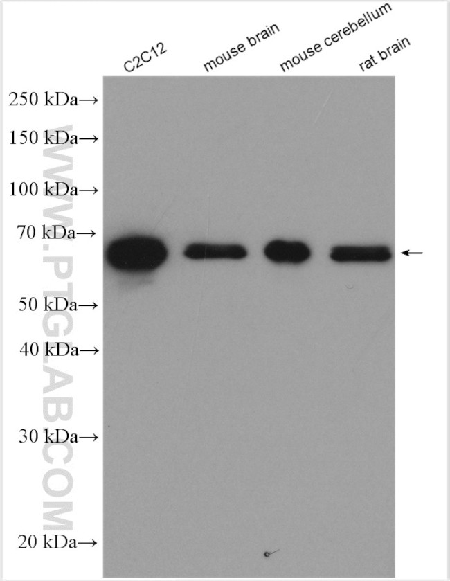 FAM134B Antibody in Western Blot (WB)