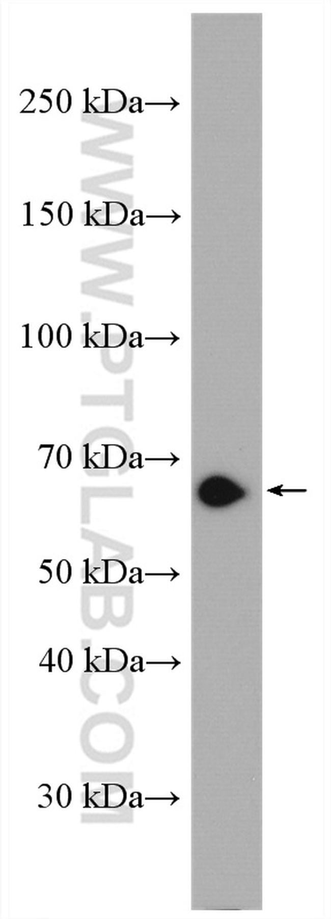 FAM134B Antibody in Western Blot (WB)