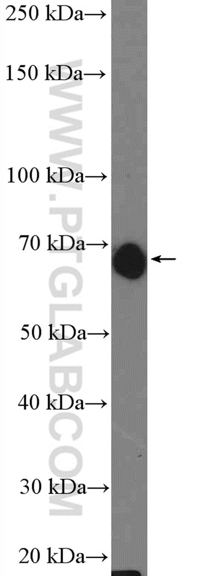 FAM134B Antibody in Western Blot (WB)