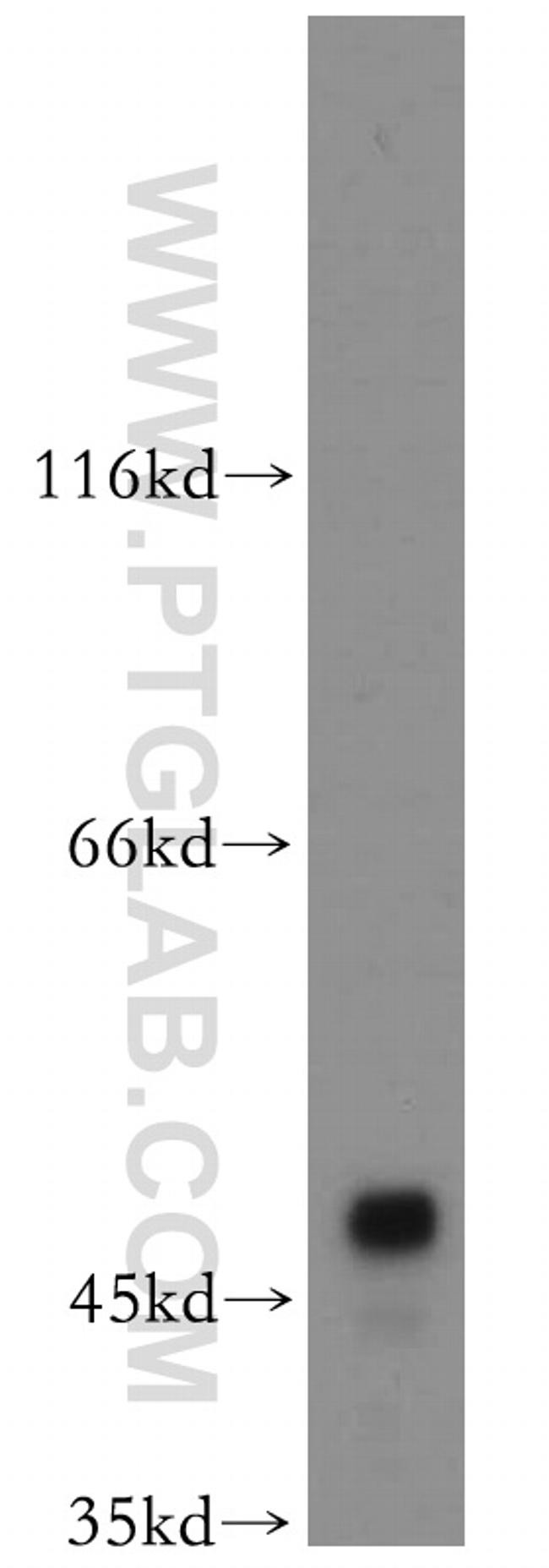 ASZ1 Antibody in Western Blot (WB)