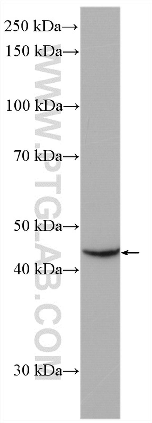 LHX5 Antibody in Western Blot (WB)
