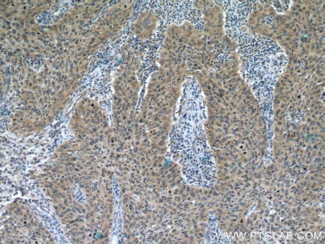 DNA2 Antibody in Immunohistochemistry (Paraffin) (IHC (P))