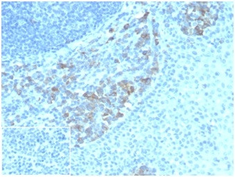 ALDH1A1 (Aldehyde Dehydrogenase 1A1) Antibody in Immunohistochemistry (Paraffin) (IHC (P))