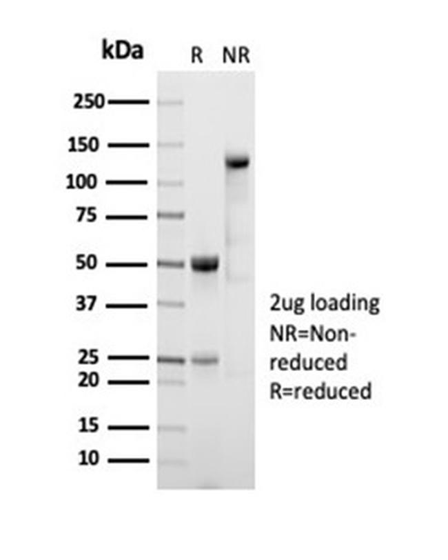 ALDH1A1 (Aldehyde Dehydrogenase 1A1) Antibody in Immunoelectrophoresis (IE)