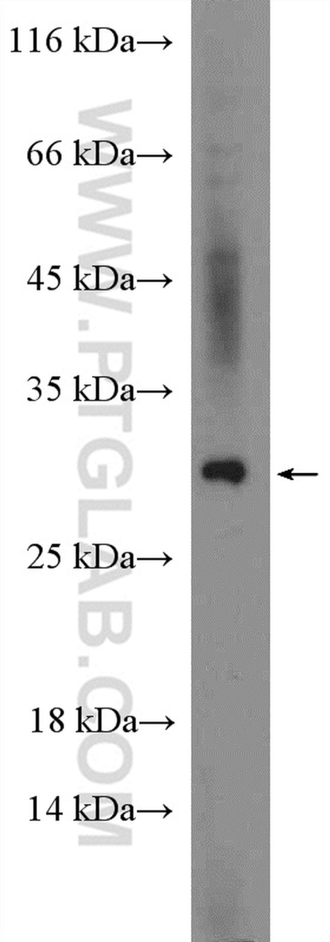 ADIPOQ Polyclonal Antibody 21613 1 AP