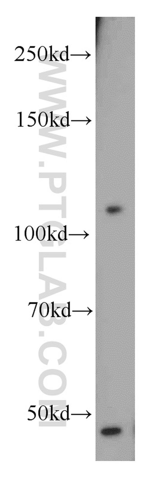 STRN Antibody in Western Blot (WB)
