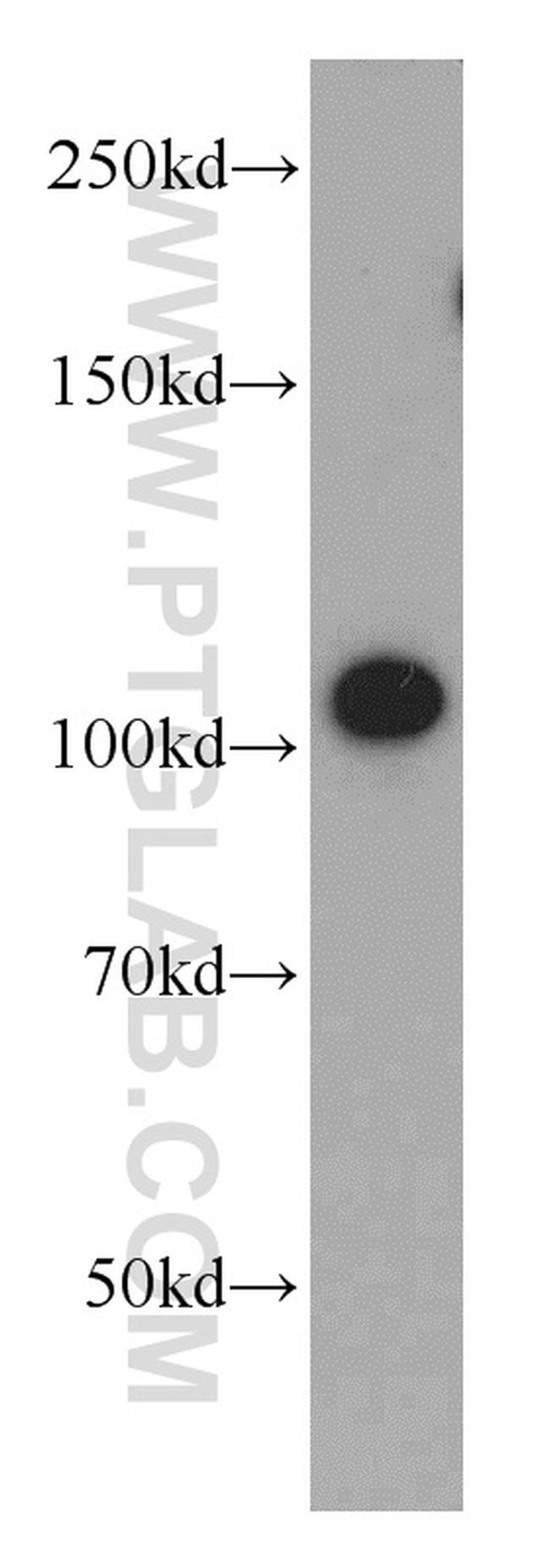 STRN Antibody in Western Blot (WB)