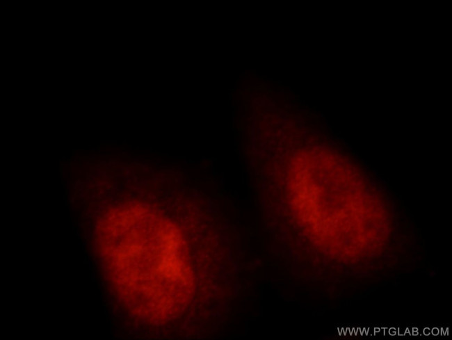 RNF20 Antibody in Immunocytochemistry (ICC/IF)