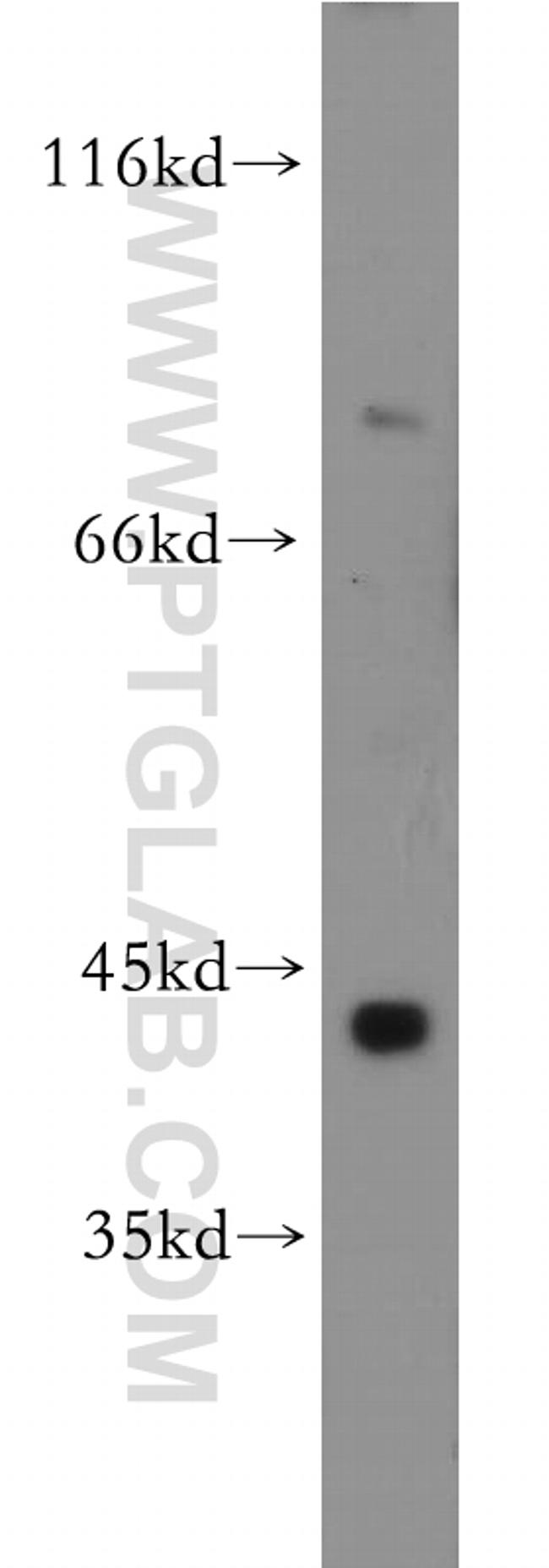 SLC5A3 Antibody in Western Blot (WB)