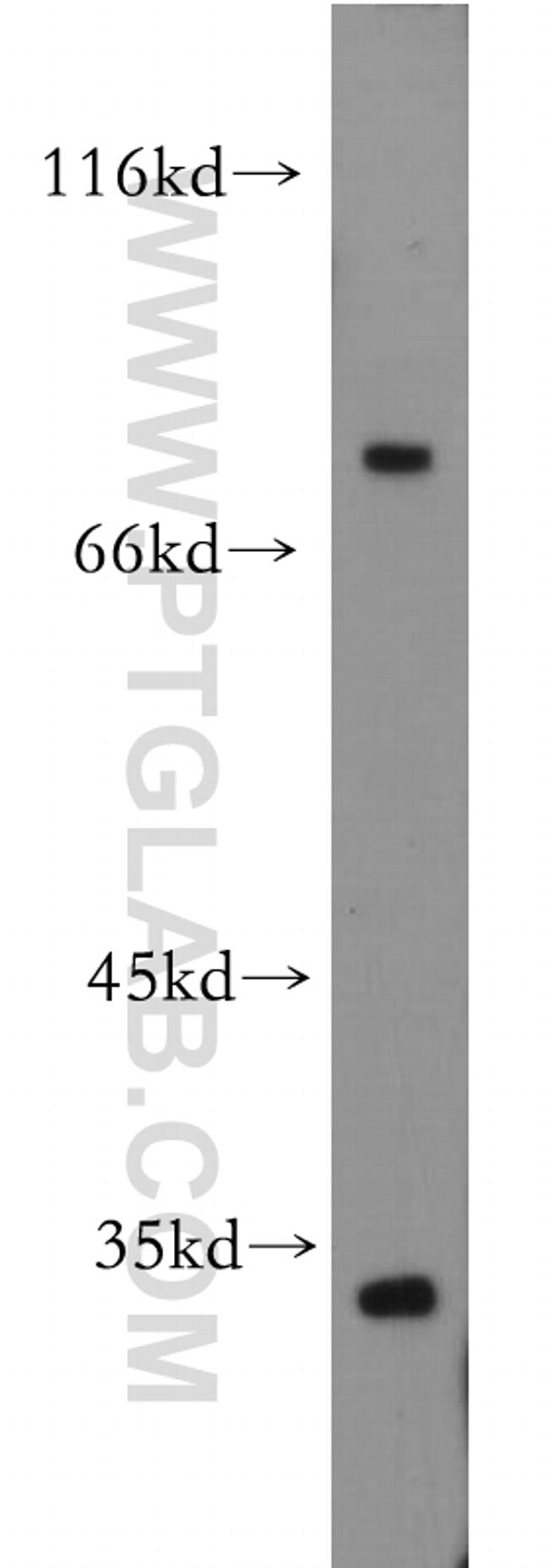 SLC5A3 Antibody in Western Blot (WB)