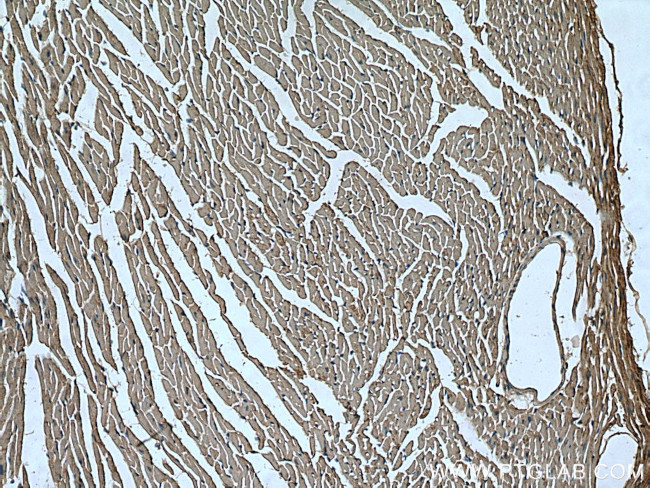 UNC45B Antibody in Immunohistochemistry (Paraffin) (IHC (P))