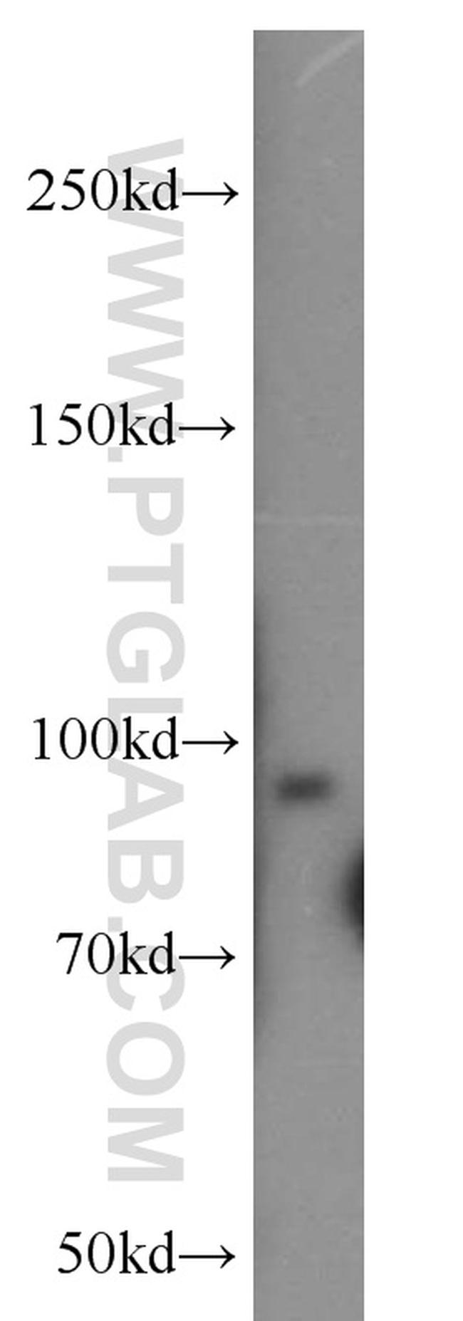 UNC45B Antibody in Western Blot (WB)