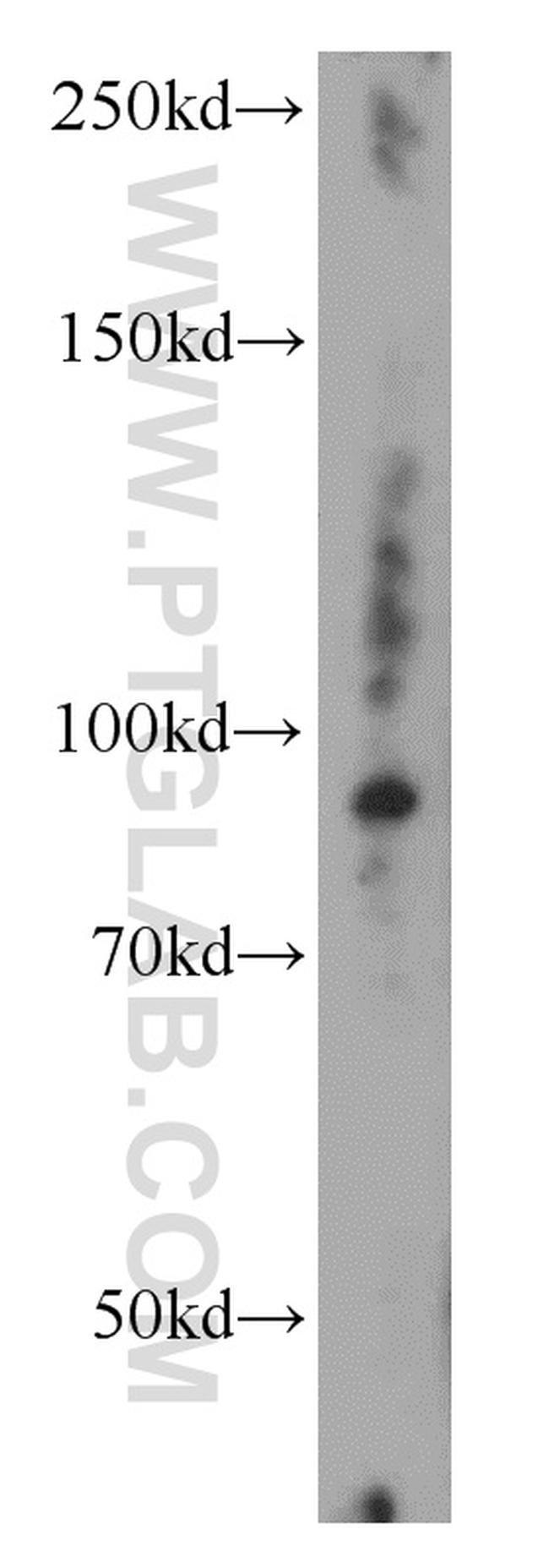 UNC45B Antibody in Western Blot (WB)