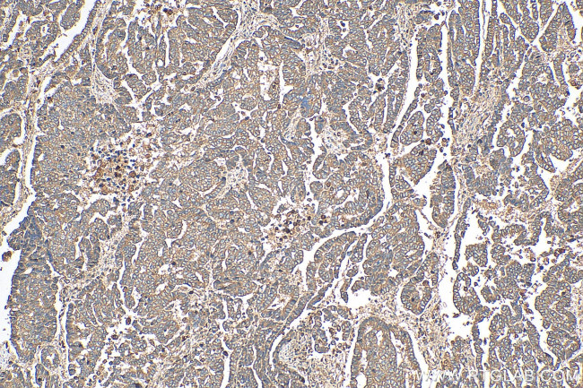 ATP5G3 Antibody in Immunohistochemistry (Paraffin) (IHC (P))