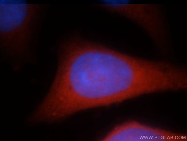 RAB3GAP1 Antibody in Immunocytochemistry (ICC/IF)