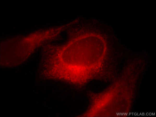 RAB3GAP1 Antibody in Immunocytochemistry (ICC/IF)