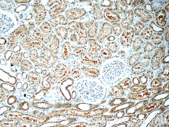 RAB3GAP1 Antibody in Immunohistochemistry (Paraffin) (IHC (P))