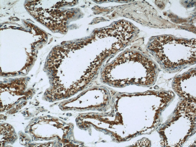 RAB3GAP1 Antibody in Immunohistochemistry (Paraffin) (IHC (P))