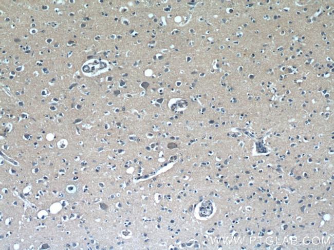 RAB3GAP1 Antibody in Immunohistochemistry (Paraffin) (IHC (P))