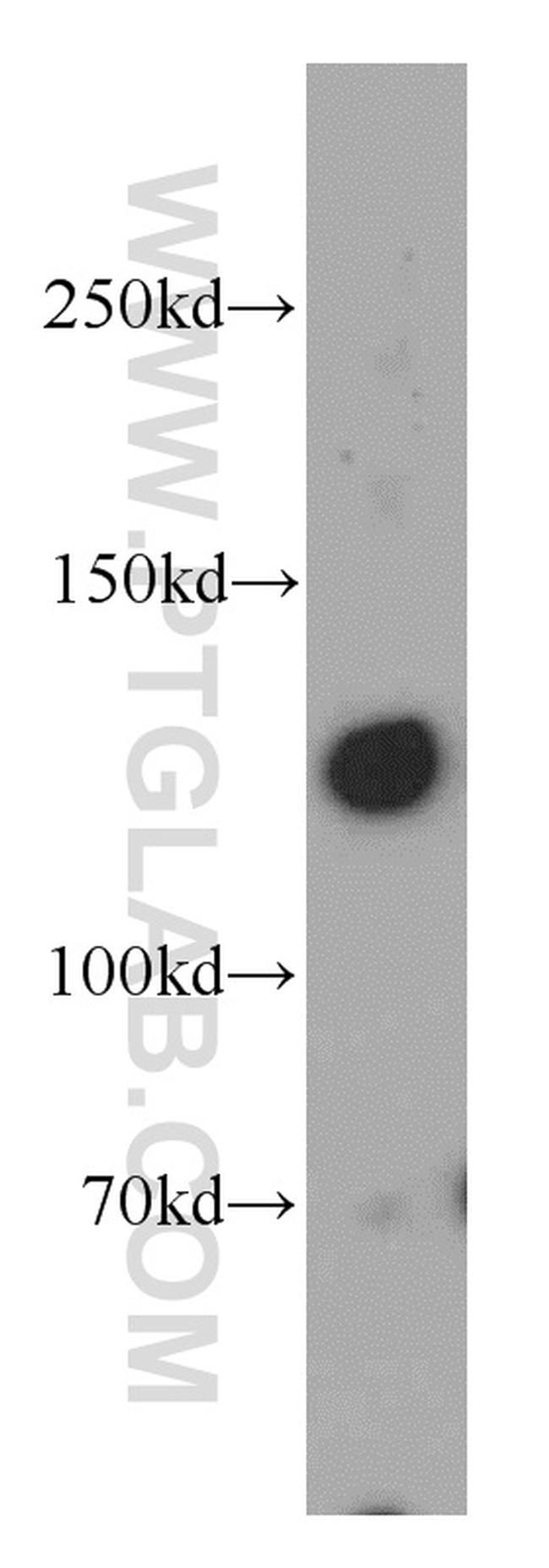 RAB3GAP1 Antibody in Western Blot (WB)