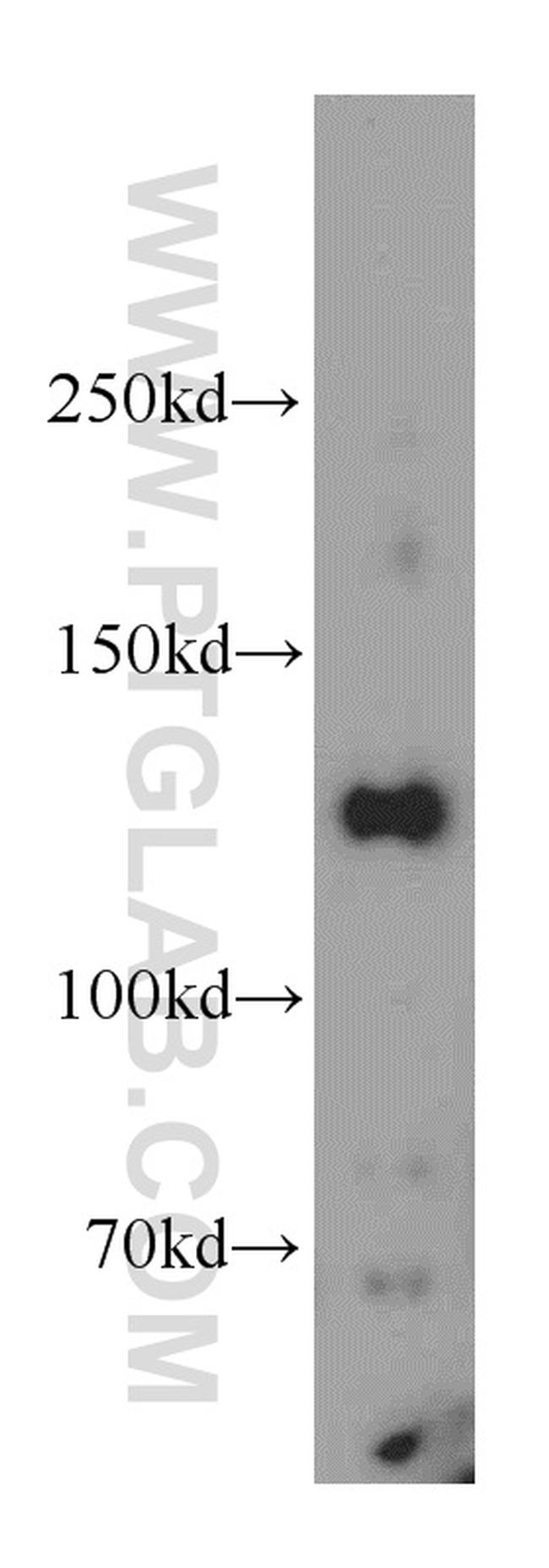 RAB3GAP1 Antibody in Western Blot (WB)