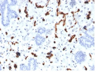 Fatty Acid Binding Protein 4 (FABP4) Antibody in Immunohistochemistry (Paraffin) (IHC (P))