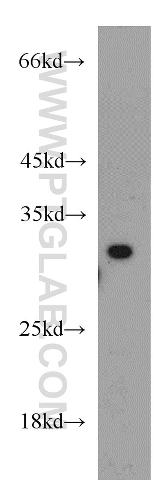 SIP1 Antibody in Western Blot (WB)