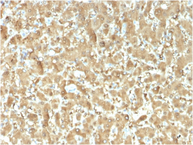 Fatty Acid Binding Protein (Liver)/FABP1 Antibody in Immunohistochemistry (Paraffin) (IHC (P))