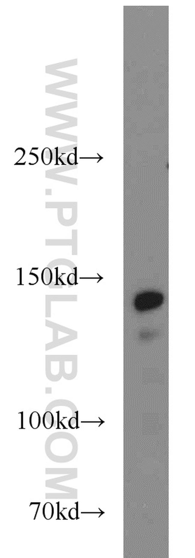 SMC1A Antibody in Western Blot (WB)