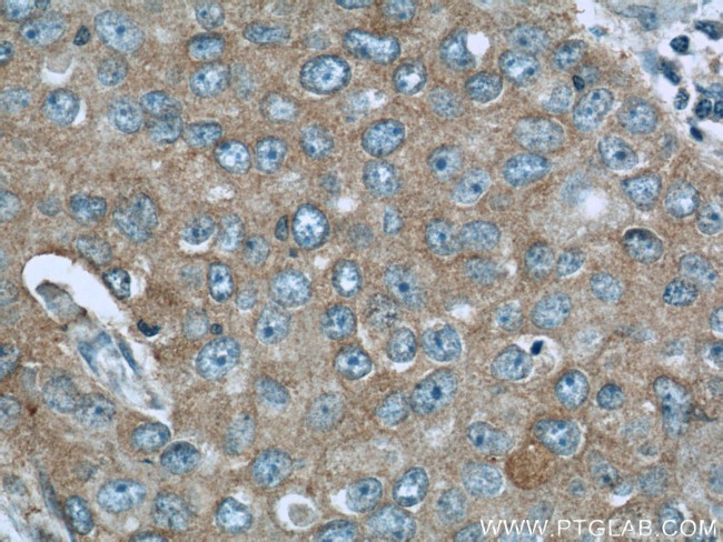 NEDD4 Antibody in Immunohistochemistry (Paraffin) (IHC (P))