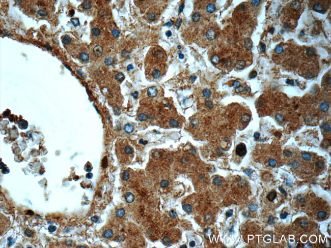 NEDD4 Antibody in Immunohistochemistry (Paraffin) (IHC (P))