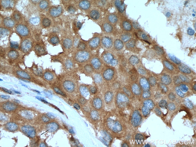 NEDD4 Antibody in Immunohistochemistry (Paraffin) (IHC (P))