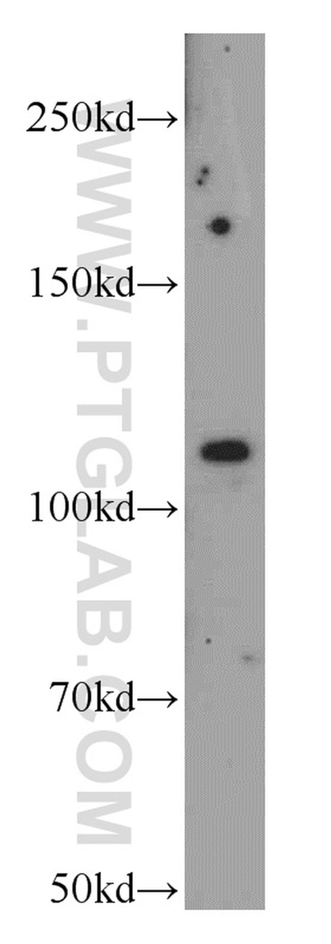 NEDD4 Antibody in Western Blot (WB)