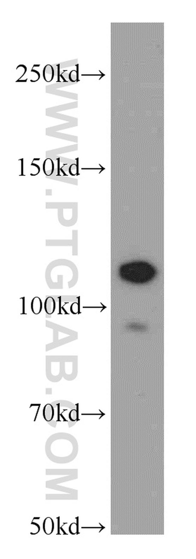 NEDD4 Antibody in Western Blot (WB)