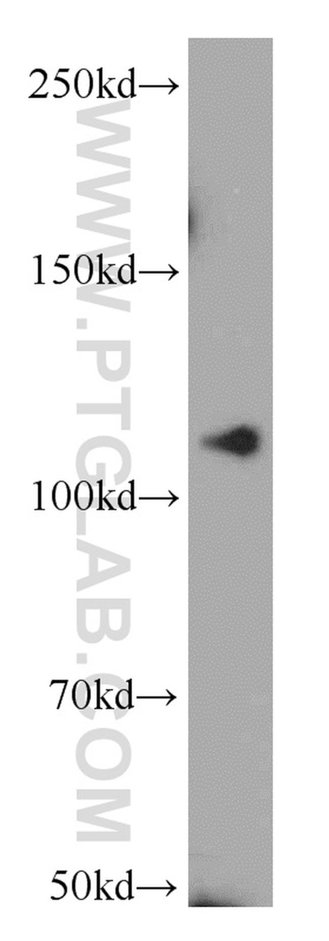 NEDD4 Antibody in Western Blot (WB)